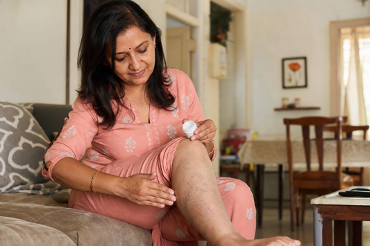 Applying varicose relief balm on lower leg